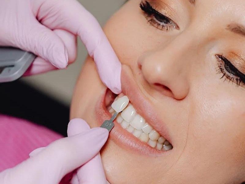 Dentist fitting dental veneer to a woman patient